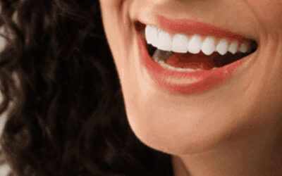 Composite Veneers vs. Porcelain: Which One Should You Choose?