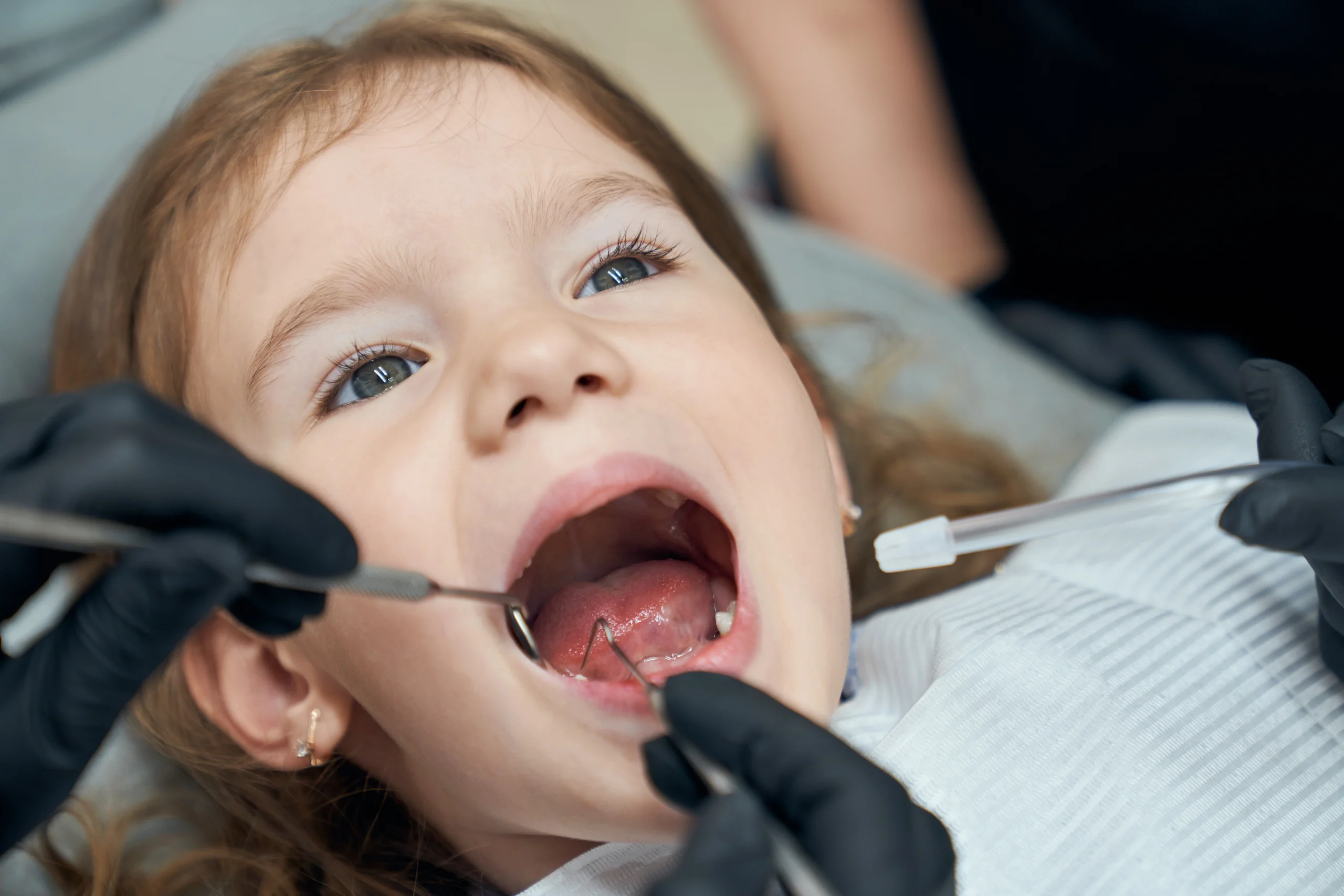 Early orthodontics assessment for a child in Winmalee