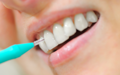 Dental Implants Aftercare: Cleaning and Long-Term Maintenance