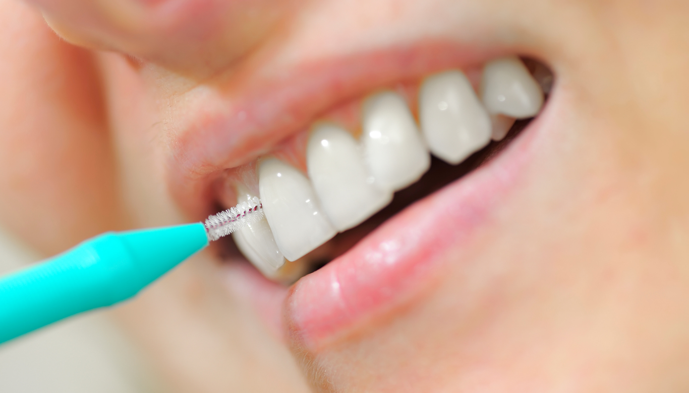 winmalee-family-smiles-denture-cleaning